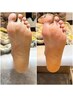 【フィト】フットトリートメント(足裏の角質ケア)でフワモチ足裏♪