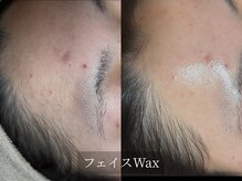 アルム(Arum)/フェイスWax