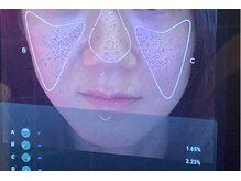 ミエリア美容鍼灸院(mielia美容鍼灸院)の雰囲気（美容鍼メニューはAI肌診断&医療連携によるレポート付でモチベup）