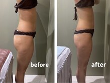 韓美 表参道店(HANMI)/ウルトラS × 銀カッサ[表参道]