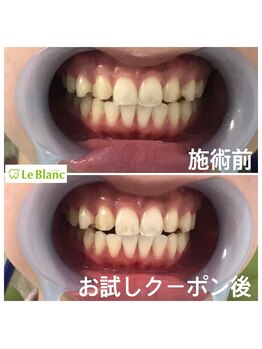 ルブラン 奈良店(Le Blanc)/ブライダル前には