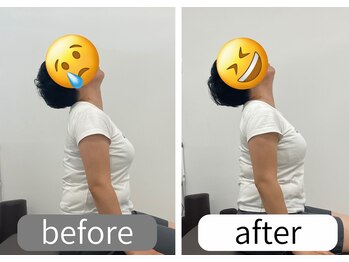 ナオル整体 大里院(NAORU整体)/上を向くと首の後ろが痛い