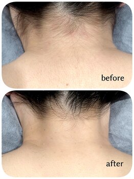 エタニティ 西宮店(Eternity)/