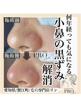リン(Rin)/毛穴エクストラクションプロ