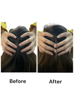 ブライトプラス(BRIGHT+)/小顔整体 頭のサイズ変化