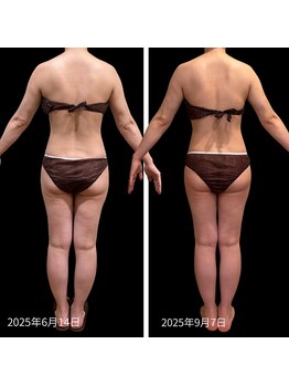 クールヴィラ(Cool Villa)/