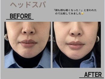 ネムリビト/小顔になりたい