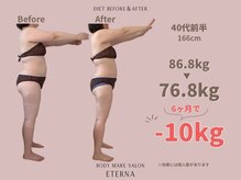 エテルナ(Eterna)/