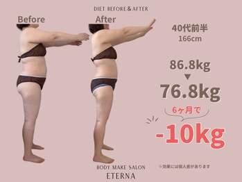 エテルナ(Eterna)/