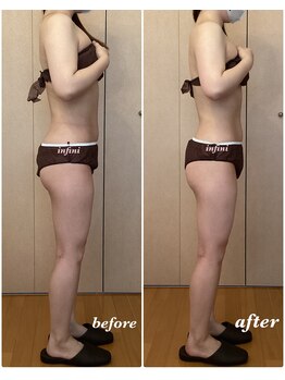 アンフィニ(infini)/短期集中全身コース5回(2ヶ月)