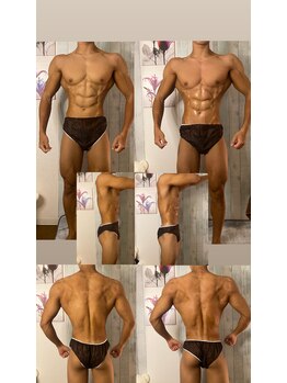 京橋メンズビューティーラボ(KMB LAB.)/ハイパーナイフのbefore/after