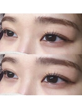 エテルニテ(eternite)/ラッシュリフト