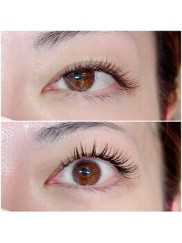 シェノン(Chainon)/バインドロック×＆Healthy