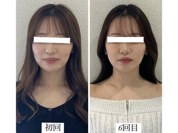 ラボーテヴェリテ(La Beaute Verite)/【お客様施術例】