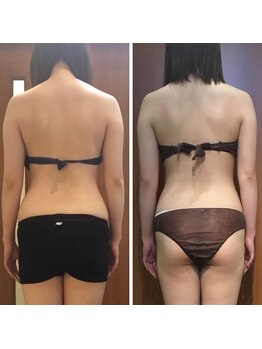 プリンセス バイ セイフティプリンセス 長野店(PRINCESS)/筋膜リリース×全身矯正♪