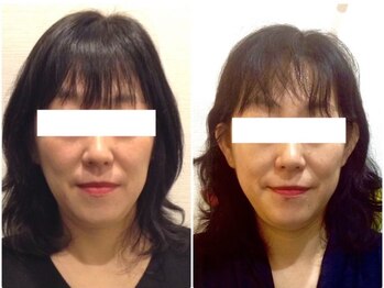 美容整体 ウェリナ 蟹江院/小顔矯正/骨盤矯正/痩身整体