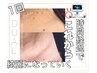 【NEW!プラペン】顔や首にできたイボ凸凹にプラズマ まずはお試し20分¥5000-