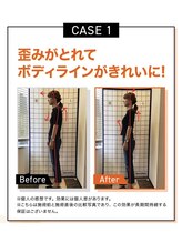 キンマク 本八幡駅前院(KINMAQ)/ビフォーアフター1