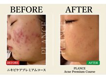 プランス 恵比寿店(PLANCE)/