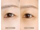 トリート アイラッシュ(TREAT eyelash)の写真