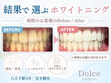 ドルチェ(Dolce)
