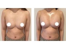 エスビューティー 三軒茶屋(S beauty)/バストアップ・三軒茶屋・痩身