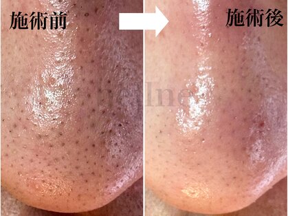 ベルネ(bellne)の写真