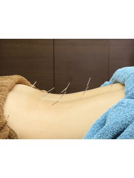 首・肩のつらさを改善したい