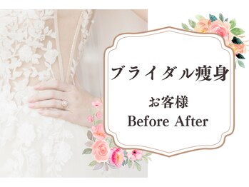エステティック ミュー(Esthetic MiEUX)/ブライダル痩身　BeforeAfter