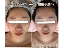 アルページュ(Arpege)/スッキリ強力弛みケア80kjが人気