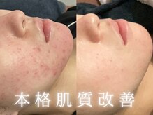 アンドイー(and E)の雰囲気（お肌のしくみを知り尽くした本格美肌サロン。美しい肌を長く実感）