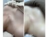 【首・肩すっきり】デコルテスペシャルトリートメント