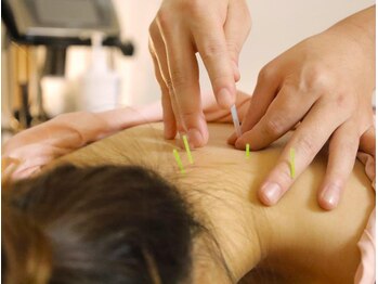 本厚木 リターナル(ReTurnal)/鍼/首肩こり