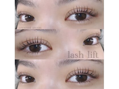 ビモア(Vimore)の写真