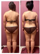 ビマリア(美-MARIA)/美BODY痩身リンパ