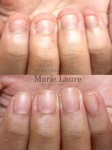 マリーロール 梅田店(Marie Laure)/深爪改善/自爪育成/ネイルケア