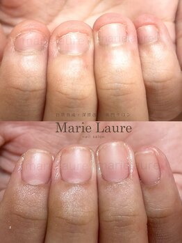 マリーロール 梅田店(Marie Laure)/深爪改善/自爪育成/ネイルケア