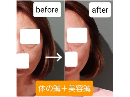 エルアンドエス(L&S)の写真