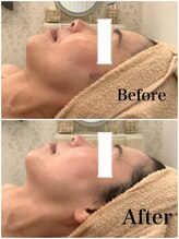 スペチアーレ 夙川/抜群の引き上がり♪