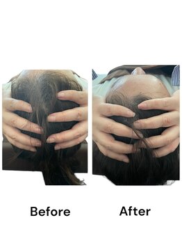 ブライトプラス(BRIGHT+)/小顔整体 頭のサイズ変化