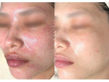 ウォナ(WONA)/【お客様症例】