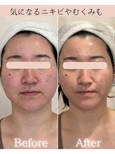 ココロ(COCORO)/1回で別人級の効果♪