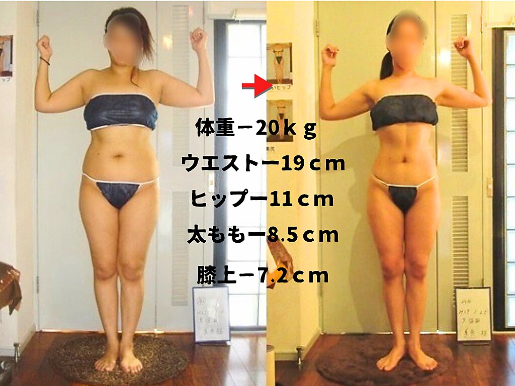 痩身 セル脂肪専門 スタイルデザイン｜ホットペッパービューティー