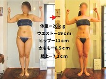 痩身 セル脂肪専門 スタイルデザインの雰囲気(体重-20kg★ウエスト-19cm★下腹部-13.5cm★)