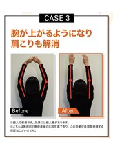 キンマク 本八幡駅前院(KINMAQ)/ビフォーアフター3