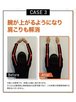 キンマク 本八幡駅前院(KINMAQ)/ビフォーアフター3