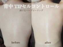 ビーピー 渋谷(b.p.)の雰囲気（背中ハーブピーリング　ニキビケア、毛孔性苔癬　ブライダル）