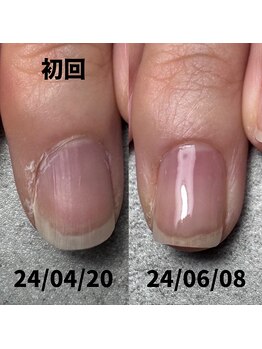 ピンク部分が伸びてきました