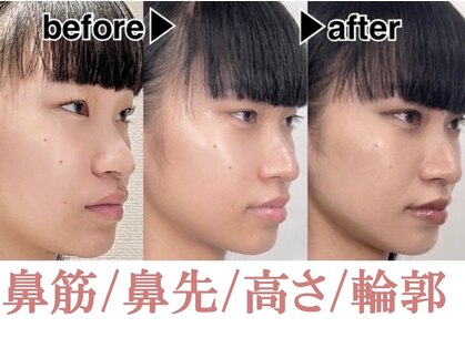 ラプリボヤージュ 藤沢店(Raplit)の写真