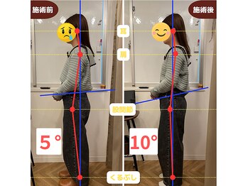 ふらっと/30代前半/美容事務 肩こり